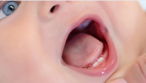 4 month 2024 old biting nipple